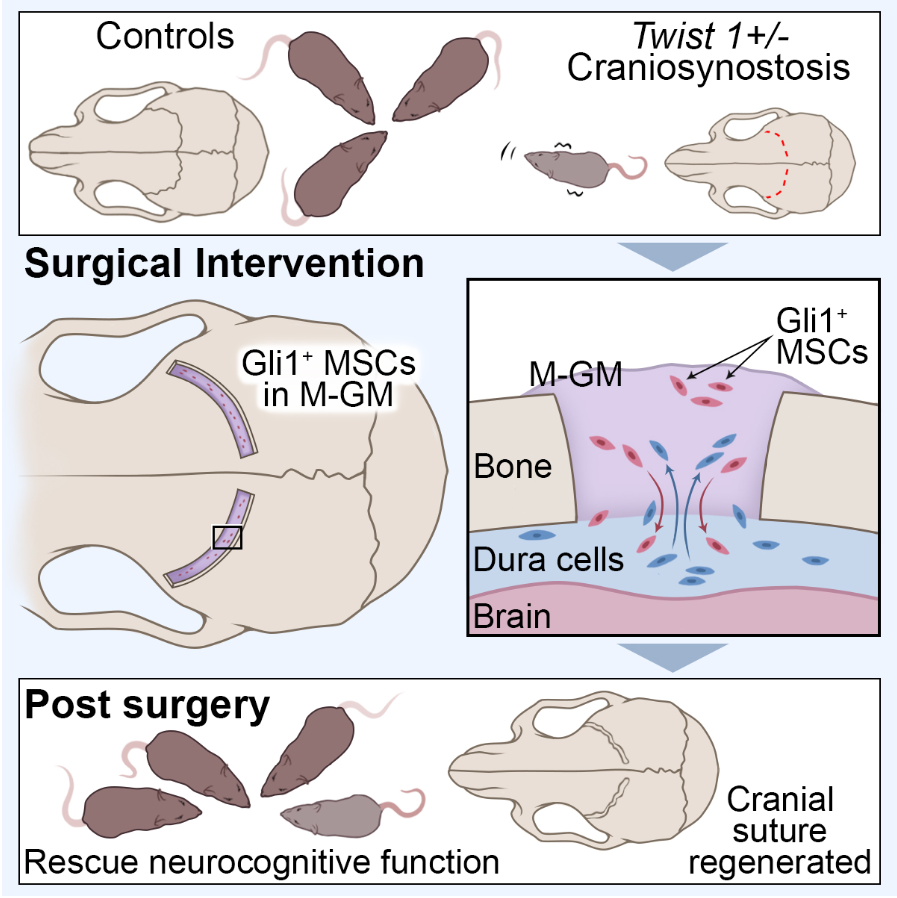 Cell！俞梦飞与南加大合作发文提出功能化颅缝再生新策略，为颅骨早闭症治疗带来新希望